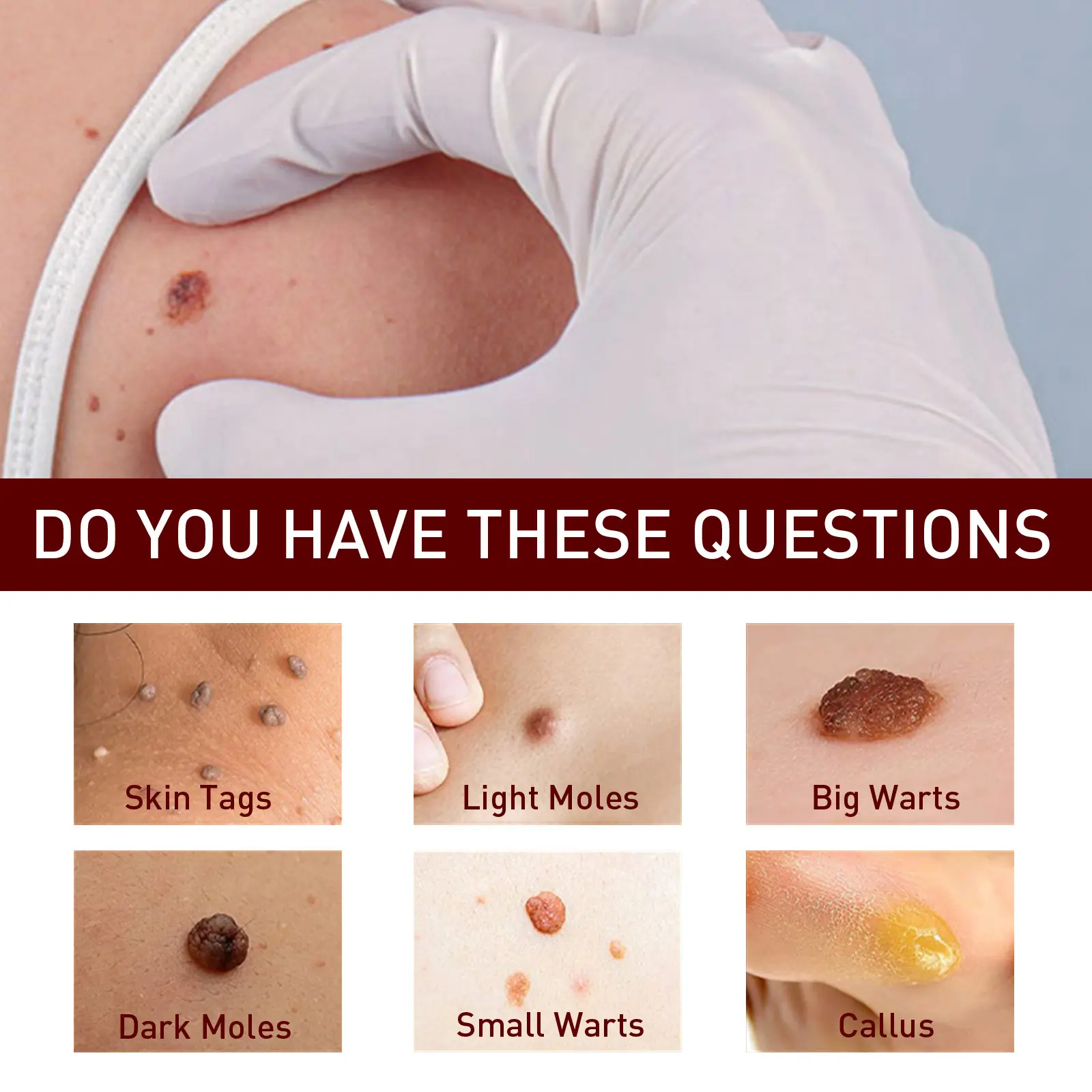 LIQUID WART FLAT - Image 3