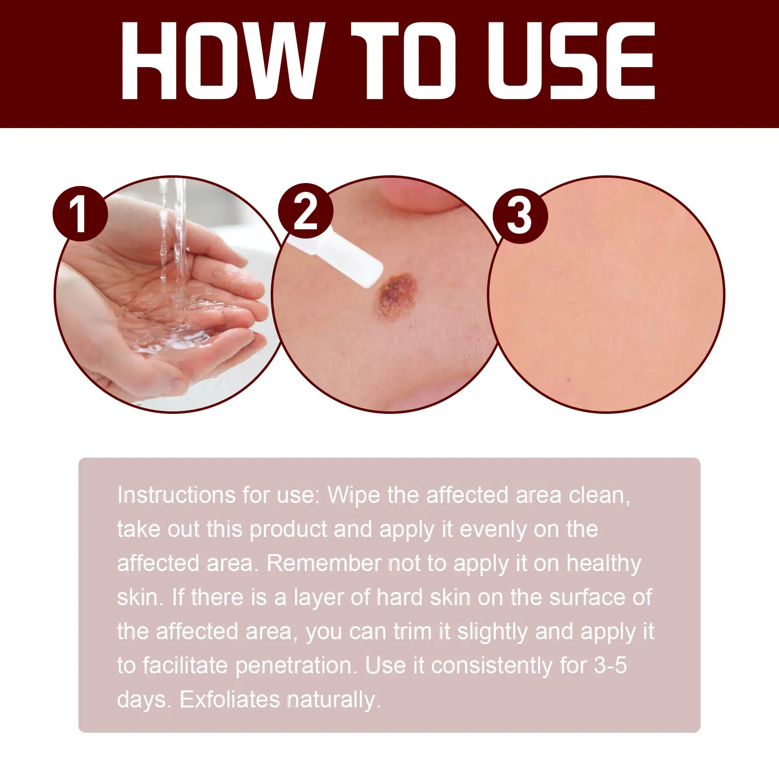 LIQUID WART FLAT - Image 4