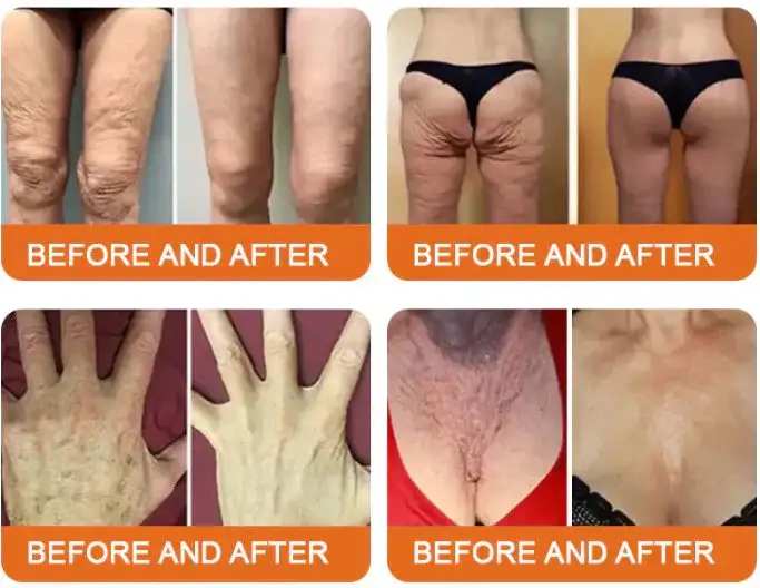 Royal Jelly Moisturizing Lifting Cream - Image 4