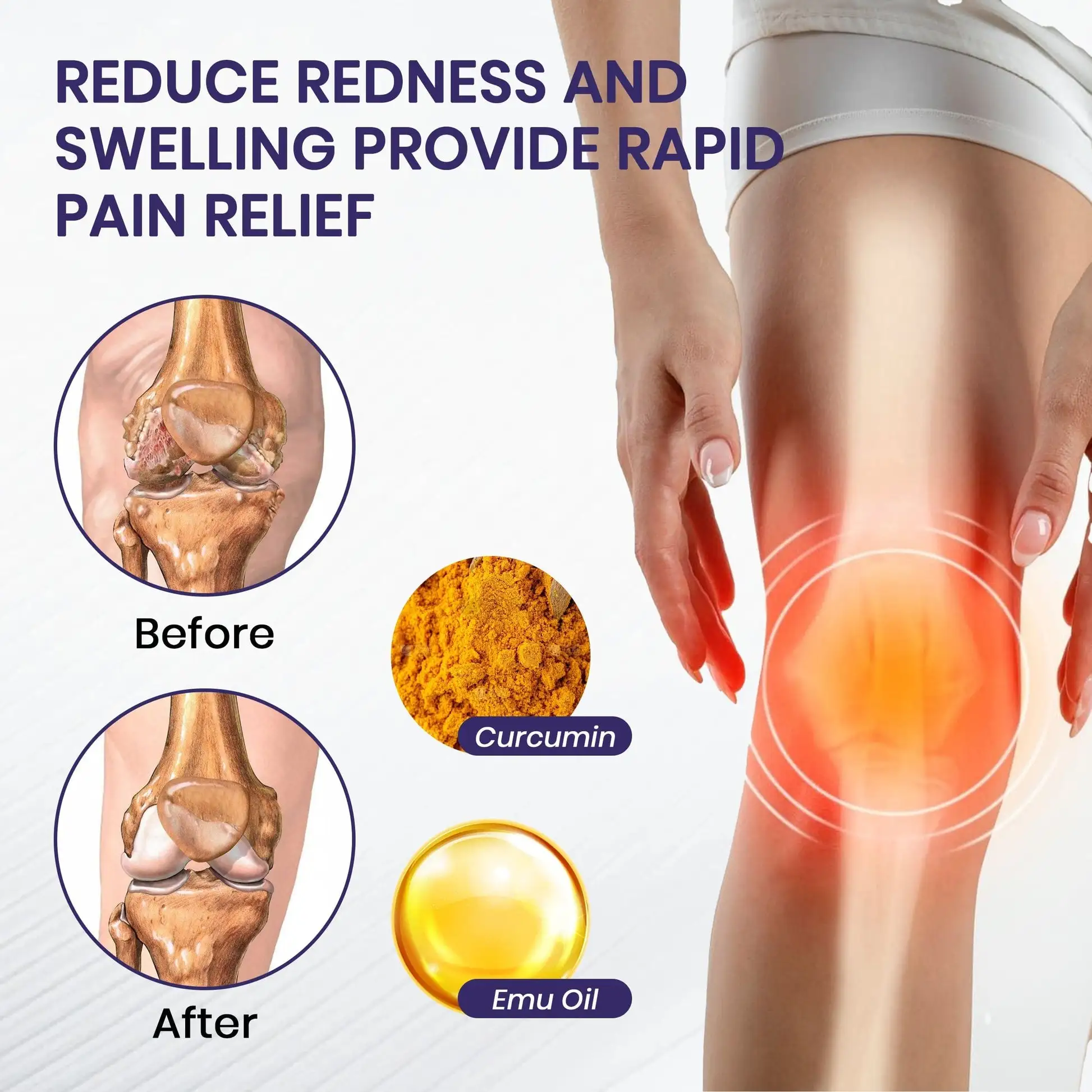 Turmeric & Emu Oil Arthritis Soothing Pain Relief Massage Gel - Image 6