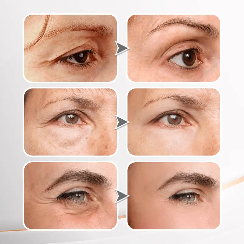 YouthfulLift Eye Firming Cream - Image 7