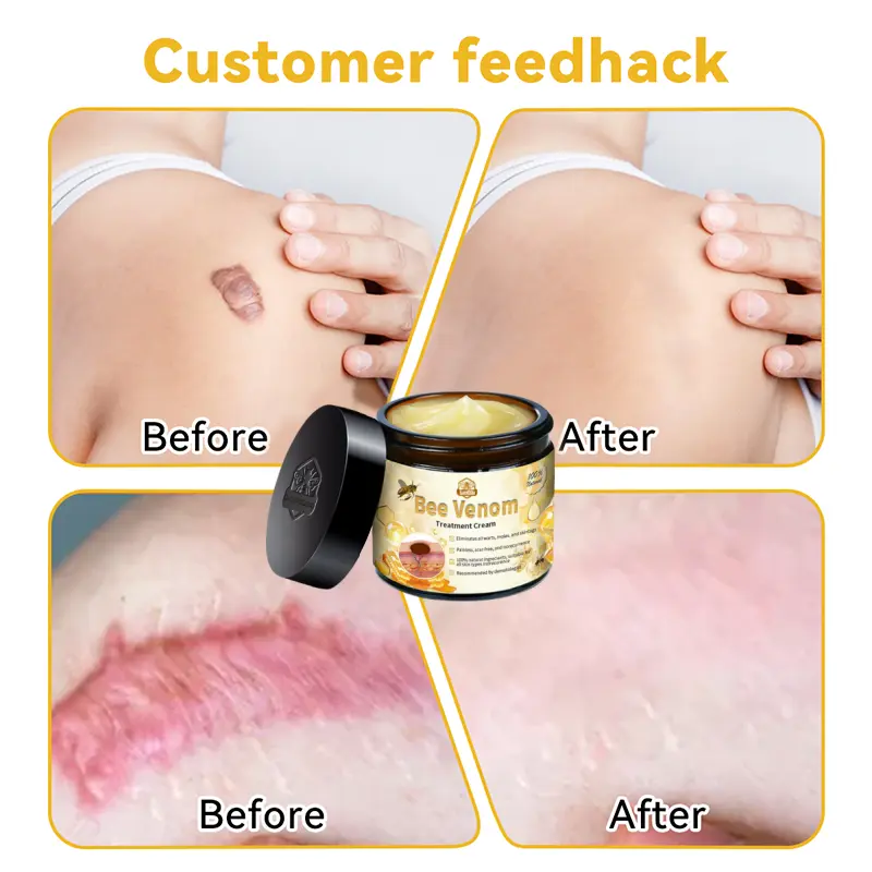 Bee Venom Skin Treatment Cream - Image 5