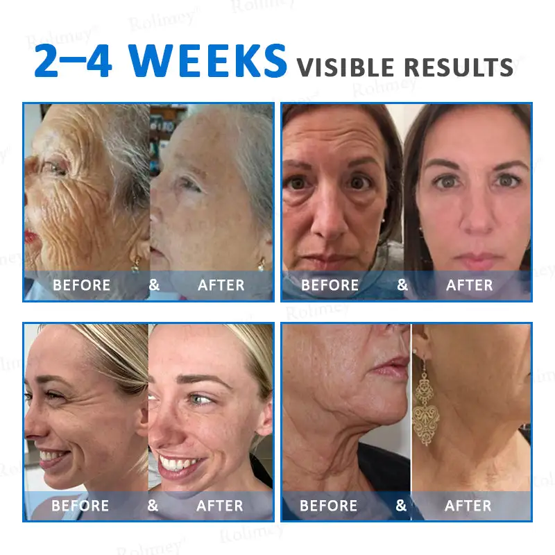 Advanced Firming & Wrinkle-Reducing Cream - Image 3