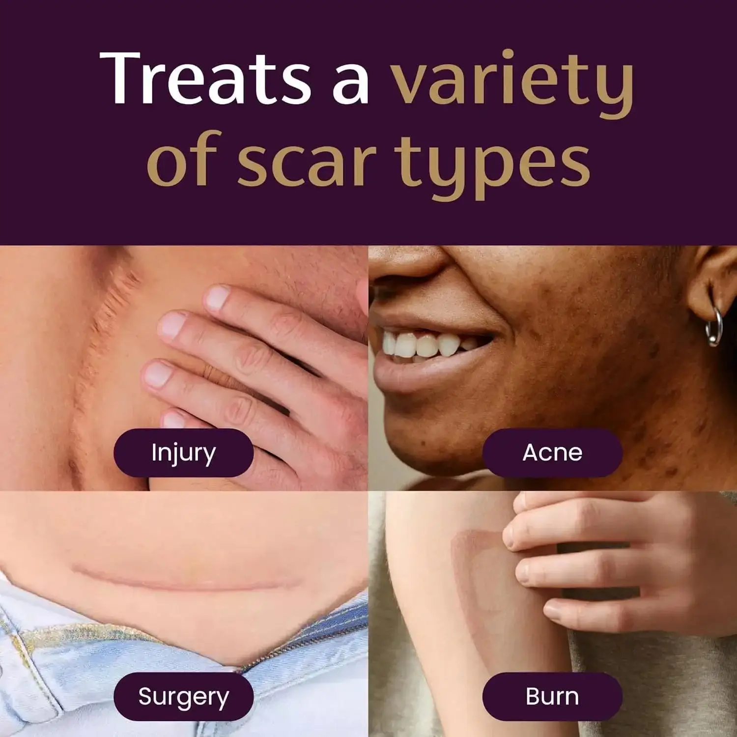 Advanced Scar Gel - Image 2