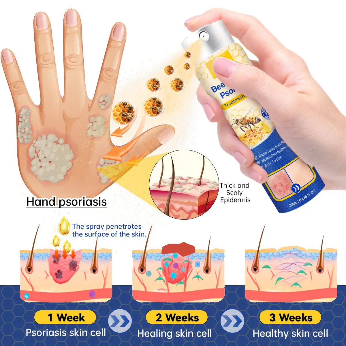 PsoriaHeal psoriasis Spray - Image 6