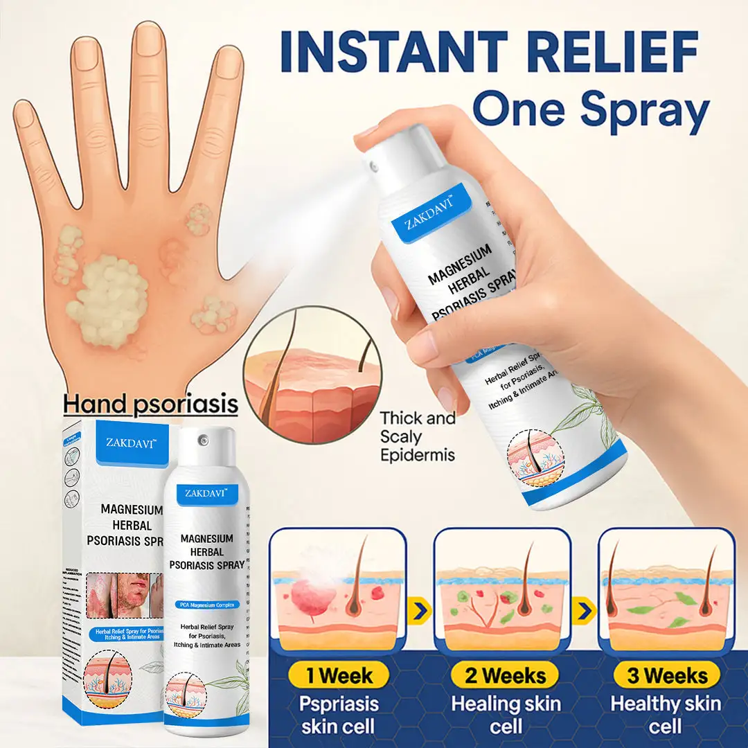 Magnesium Herbal Psoriasis Spray - Image 12