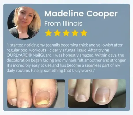 NailGuard Fungal Repair Herbal Spray - Image 10