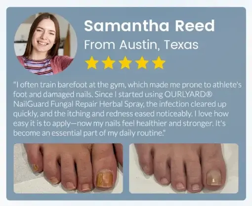 NailGuard Fungal Repair Herbal Spray - Image 12