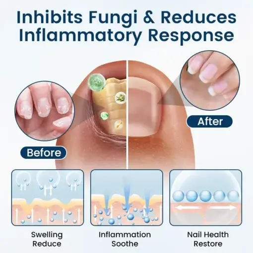 NailGuard Fungal Repair Herbal Spray - Image 2