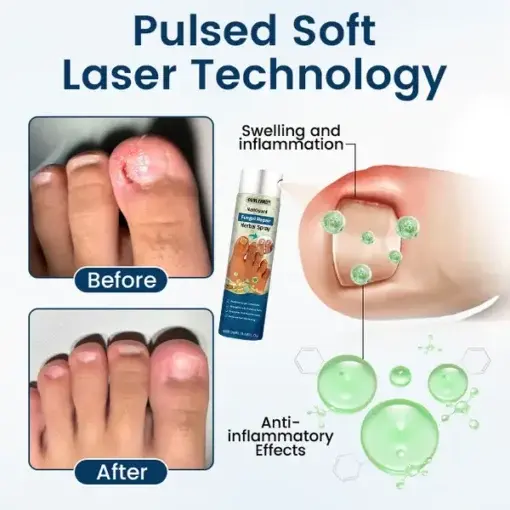 NailGuard Fungal Repair Herbal Spray - Image 4