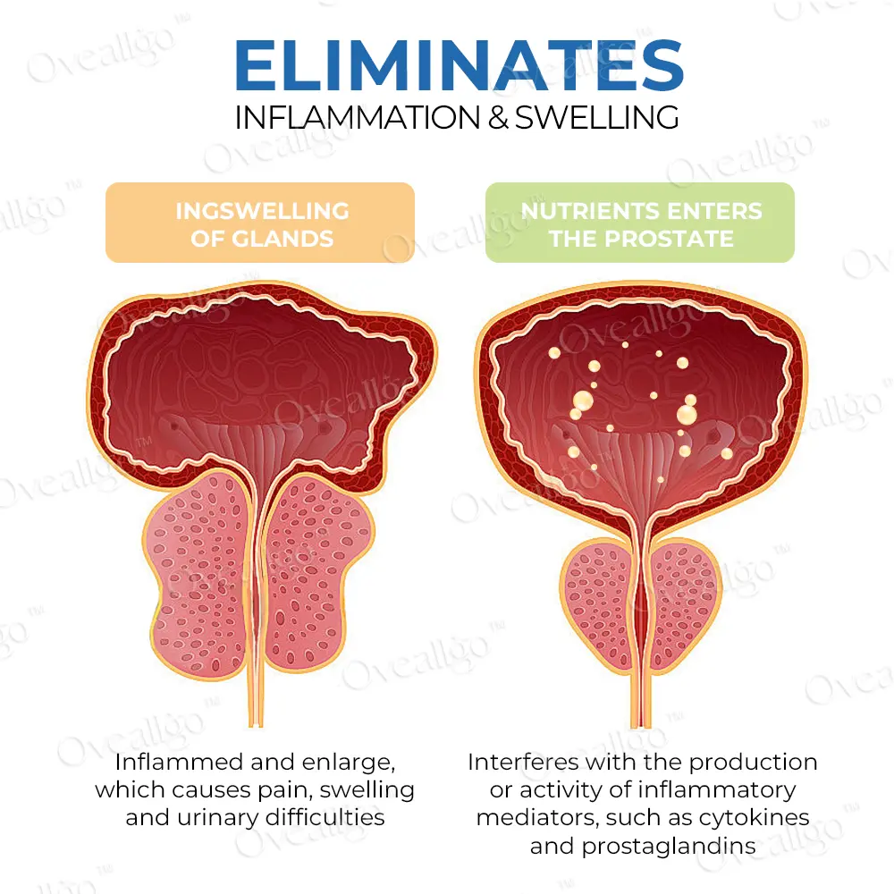 EXTRA ProstaAce PT-141 Nasal Spray - Image 5