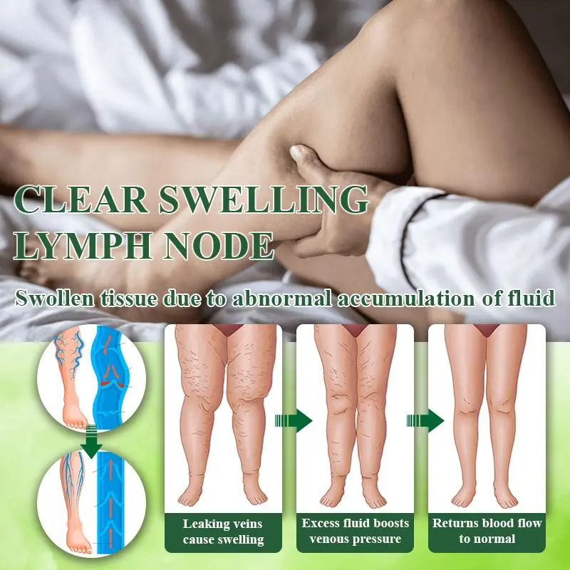 VeinoRoll Therapy Edema Comfort Cream - Image 8