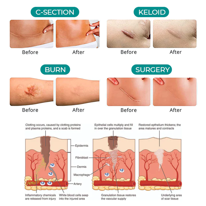 Medical Scar Removal Spray - Image 5