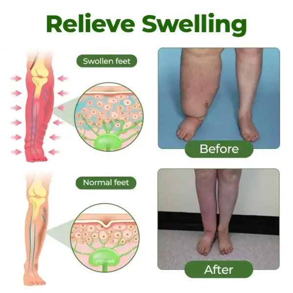 Professional Leg Circulation Cream