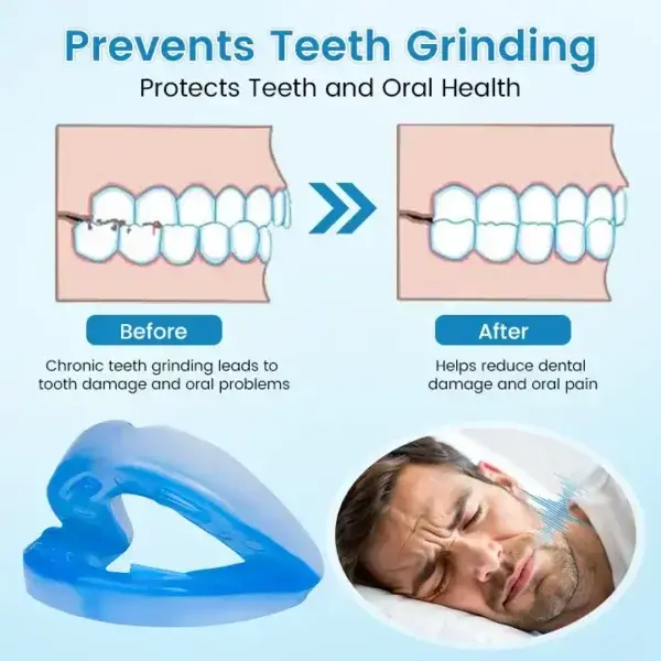 QIAWI ™ Anti-Snoring & Anti-Grinding Teeth Protector - Image 5