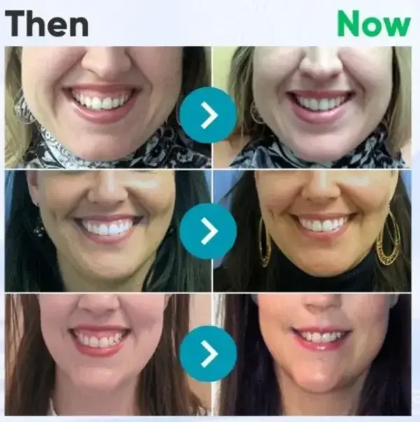 VioGloss Bee Venom Dental Therapy Oral Power - Image 11