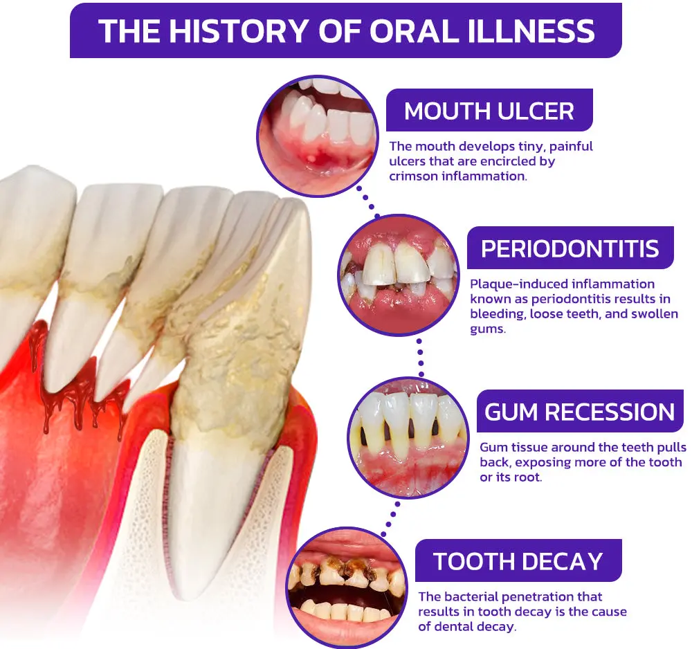 VioGloss Bienengift-Zahntherapie Oral Power - Image 8