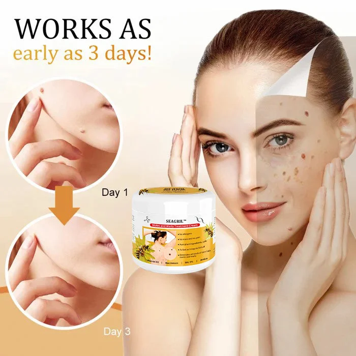 Bee Venom Mole and Wart Treatment Cream - Image 3