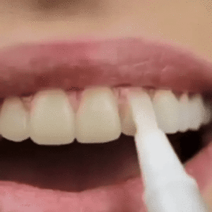 Alternative view of Teeth Whitening Pen