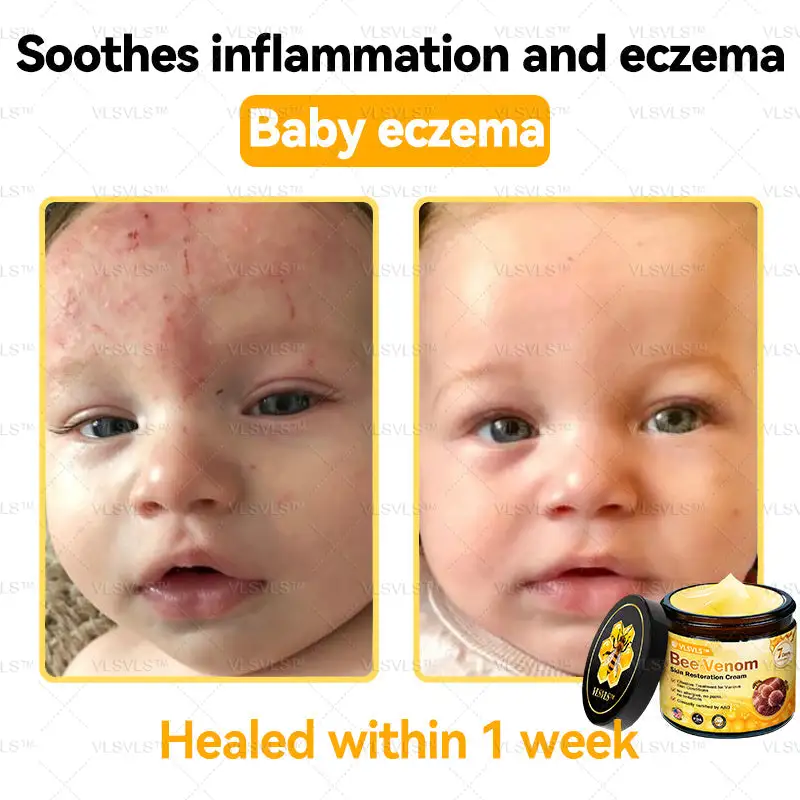 Special Sale Bee Venom Skin Restoration Cream - Image 4