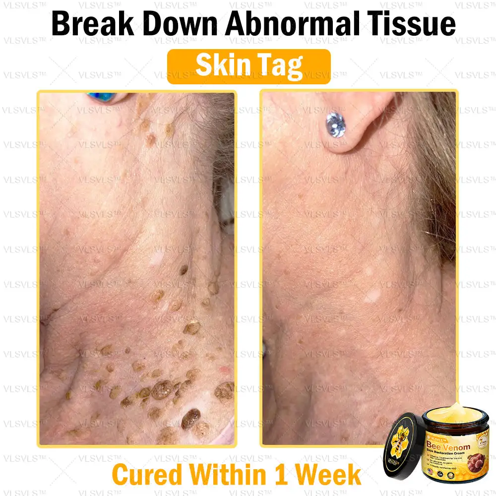 Special Sale Bee Venom Skin Restoration Cream - Image 6