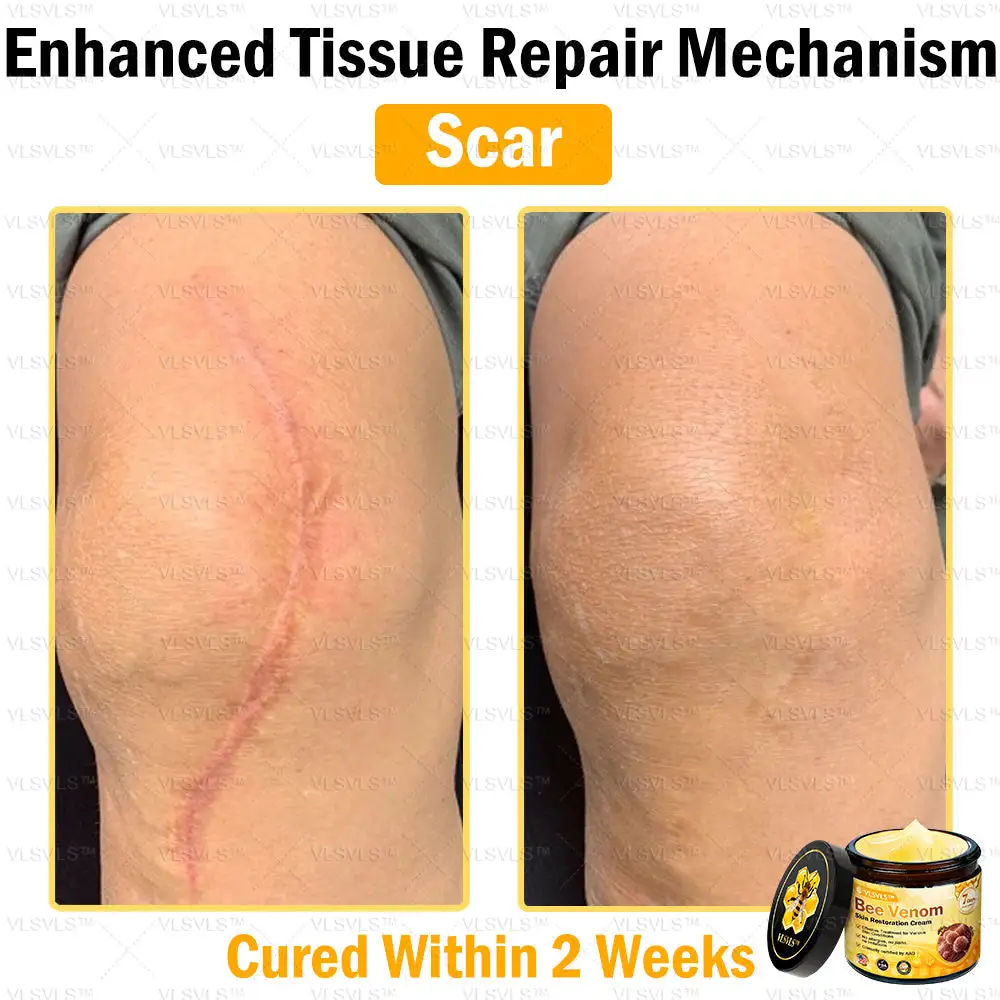 Special Sale Bee Venom Skin Restoration Cream - Image 7