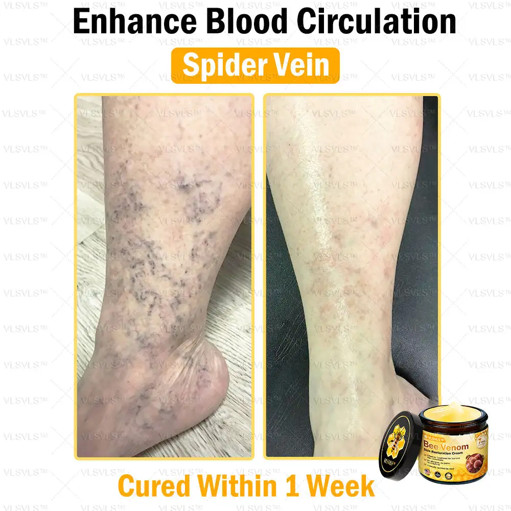 Special Sale Bee Venom Skin Restoration Cream - Image 9