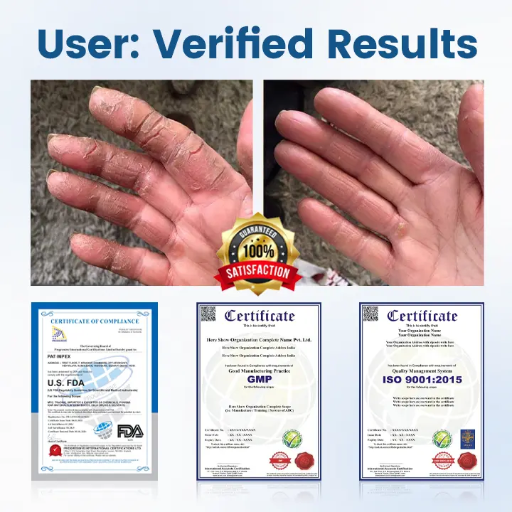 AngioVita Diabetic Care Spray - Image 5