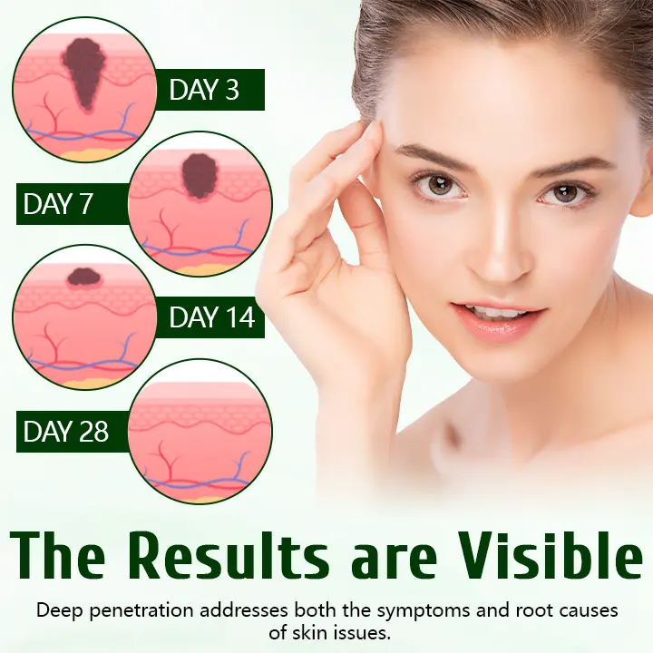 DermaPure Tea Tree Healing Cream - Image 4