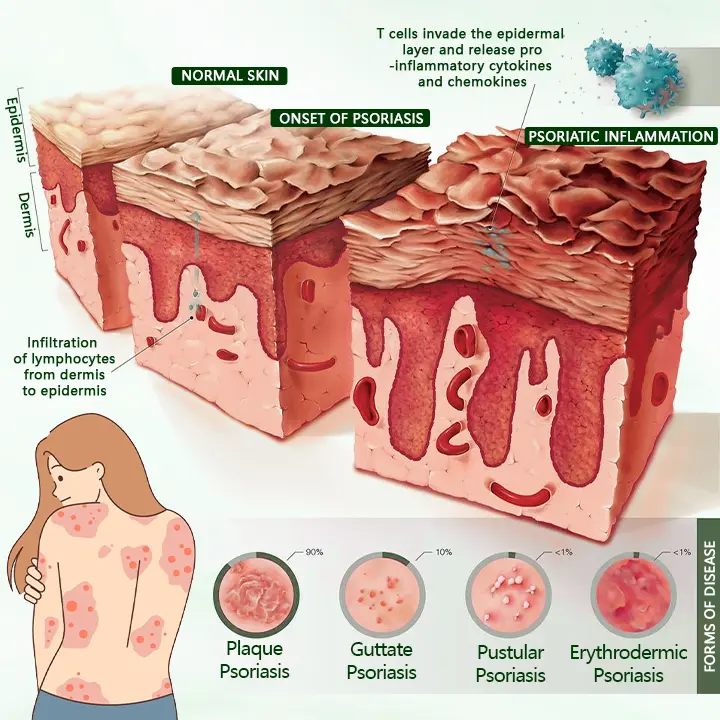 DermaPure Tea Tree Healing Cream - Image 6