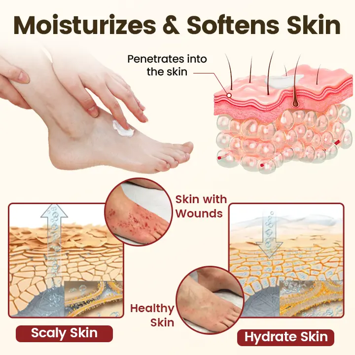 DiaRelief Healing Cream - Image 8