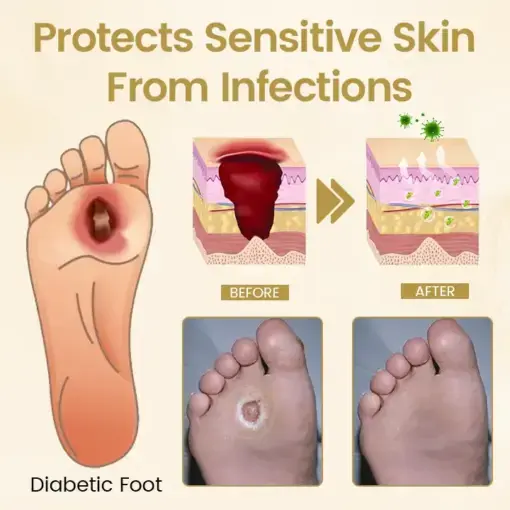 Diabetic Foot Healing Spray - Image 3