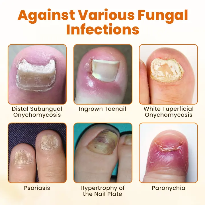 FungiBee Advanced Nail Repair Spray - Image 7