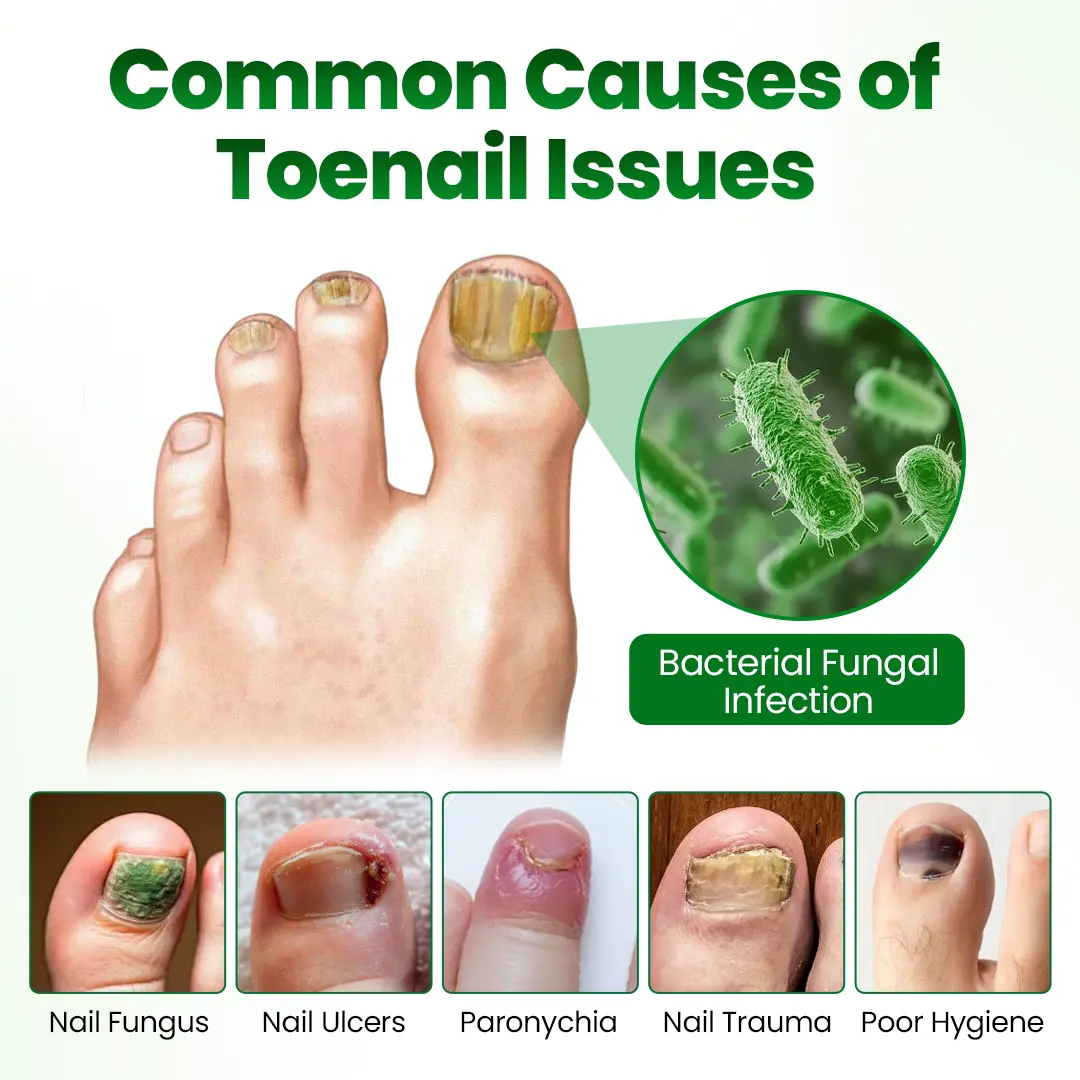 HerbaNail 7-Day Repair Serum - Image 5