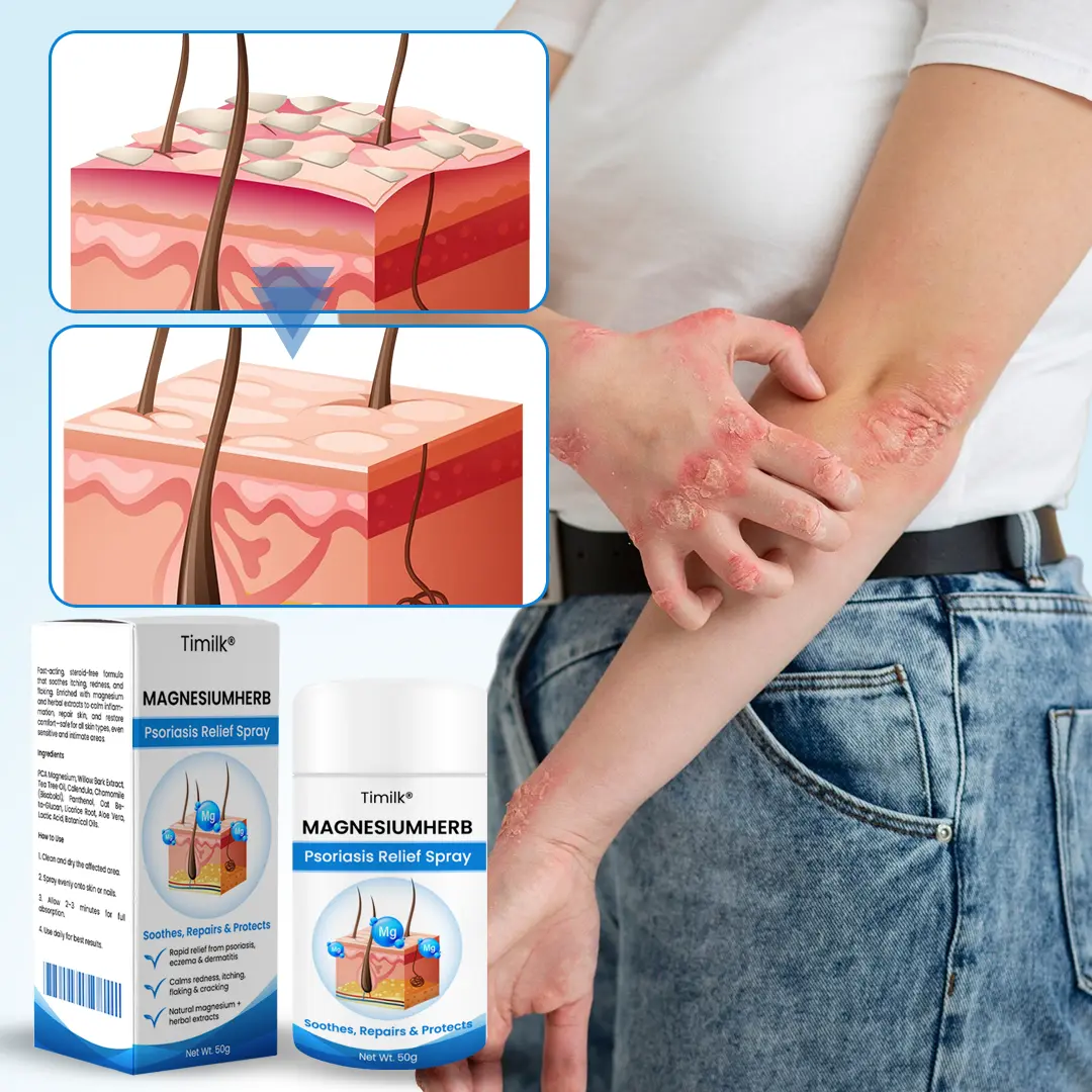 MagnesiumHerb Psoriasis Relief Cream - Image 4