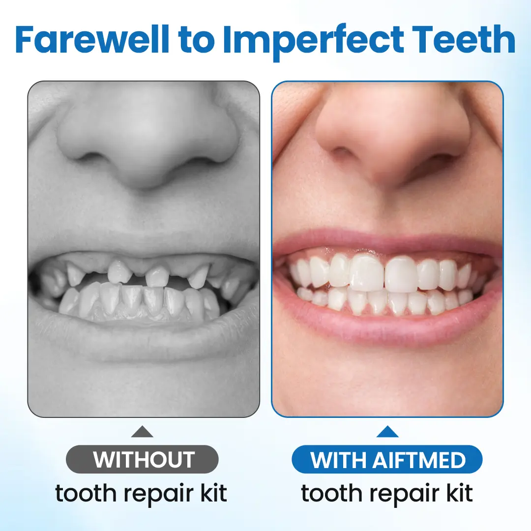 SmileMend Tooth Repair Filling Kit - Image 3