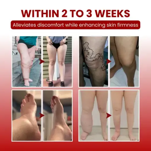 SwellCare Professional Lymphatic Drainage Massage Cream - Image 2