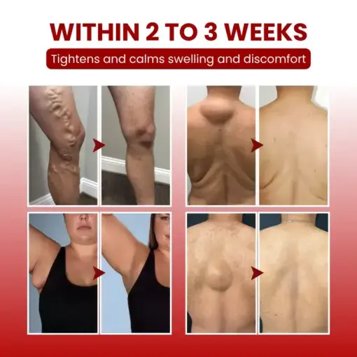 SwellCare Professional Lymphatic Drainage Massage Cream - Image 3