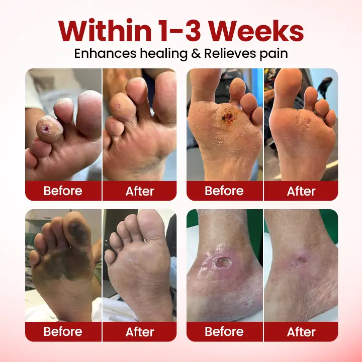 VitaGluco Diabetic Care Cream - Image 3