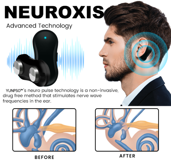 Tinnitus Relief Device Serenity