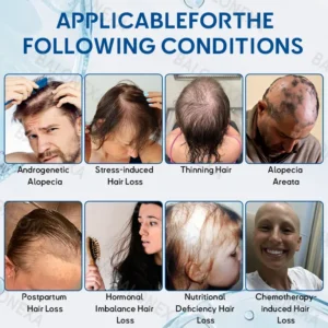 Alternative view of 𝙎𝙏𝙀𝙈 𝘾𝙚𝙡𝙡 𝙃𝙖𝙞𝙧 𝘾𝙮𝙘𝙡𝙚 𝙍𝙤𝙡𝙡𝙚𝙧