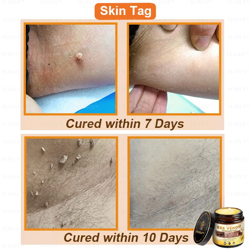Bee Venom Skin Restoration Cream - Image 3