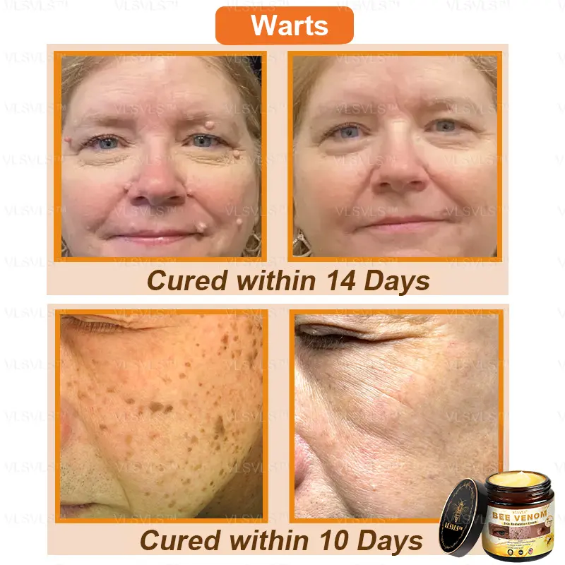 Bee Venom Skin Restoration Cream - Image 4