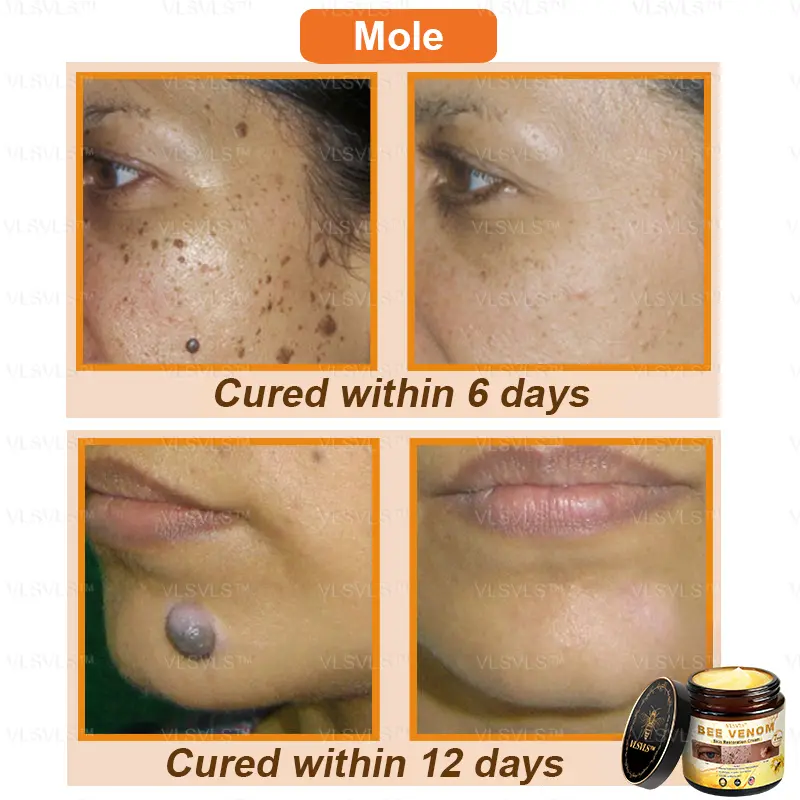 Bee Venom Skin Restoration Cream - Image 5