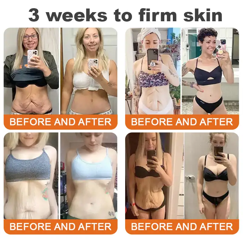 Winter Sale Botox Bee Venom Firming Serum Stick - Image 2