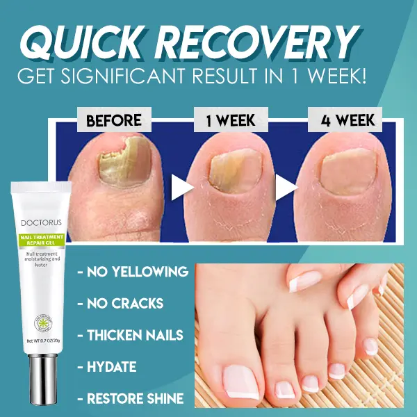Fungus Nail Repair Gel - Image 2
