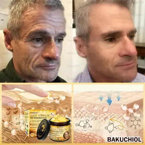 ๐ฉ๐๐ ๐ฝ๐๐๐๐ ๐บ๐๐๐ ๐น๐๐๐๐๐ & ๐จ๐๐๐-๐จ๐๐๐๐ ๐ช๐๐๐๐ - Image 10