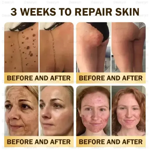 ๐ฉ๐๐ ๐ฝ๐๐๐๐ ๐บ๐๐๐ ๐น๐๐๐๐๐ & ๐จ๐๐๐-๐จ๐๐๐๐ ๐ช๐๐๐๐ - Image 5