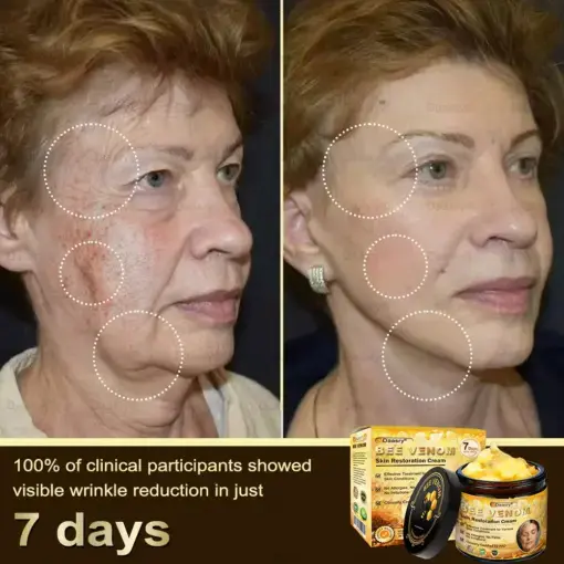 ๐ฉ๐๐ ๐ฝ๐๐๐๐ ๐บ๐๐๐ ๐น๐๐๐๐๐ & ๐จ๐๐๐-๐จ๐๐๐๐ ๐ช๐๐๐๐ - Image 7