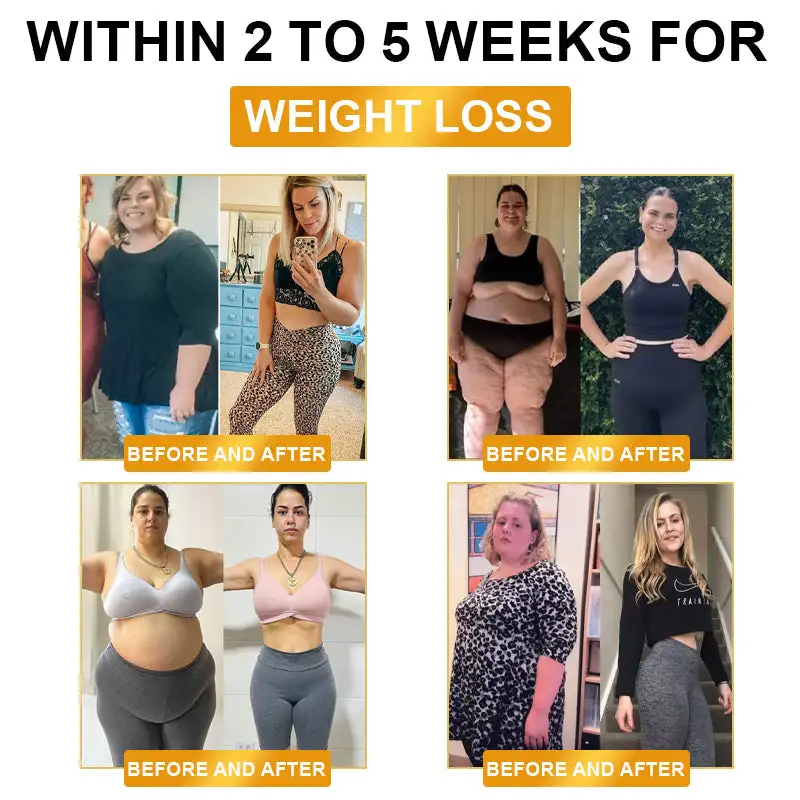 ๐จ๐น๐๐ฟ๐ฎ๐๐ผ๐ป๐ถ๐ฐ ๐๐ฎ๐ ๐๐น๐ฎ๐๐๐ถ๐ป๐ด ๏ผ ๐๐ฎ๐ฟ ๐๐ป๐ณ๐ฟ๐ฎ๐ฟ๐ฒ๐ฑ ๐๐น๐ผ๐ผ๐ฑ ๐ฆ๐๐ด๐ฎ๐ฟ ๐๐ฎ๐น๐ฎ๐ป๐ฐ๐ถ๐ป๐ด ๐๐ฒ๐๐ผ๐
๐ช๐ฟ๐ถ๐๐๐ฏ๐ฎ๐ป๐ฑ - Image 4